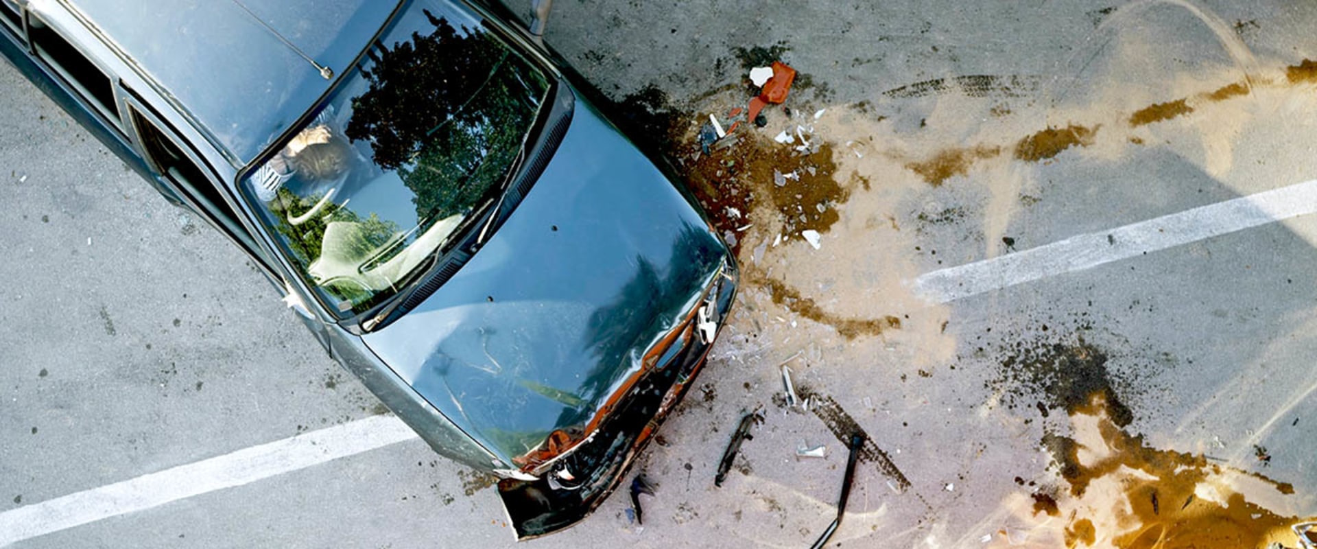 Amputation Injury Lawyer in Delaware County, PA After Work, Vehicle & Medical Accidents